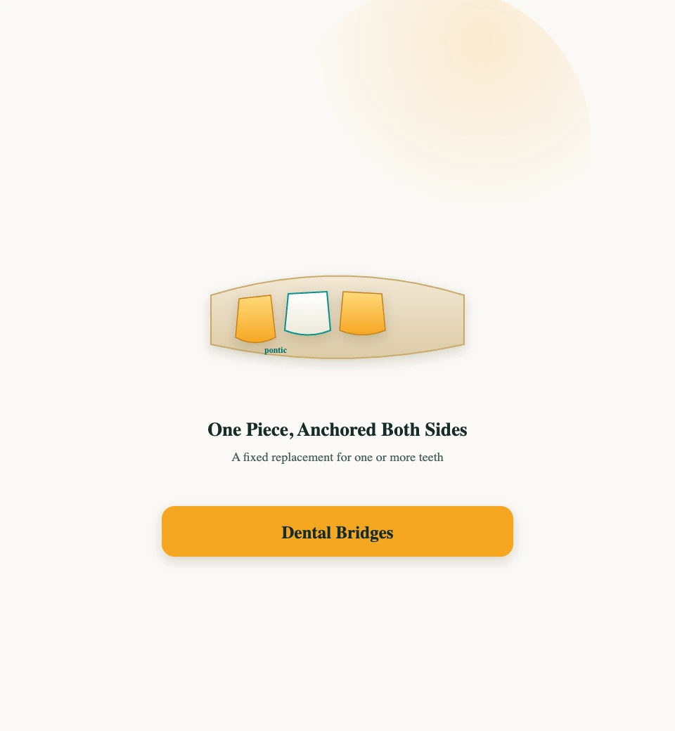 Dental Bridges at PlanDental, Mahim, Mumbai