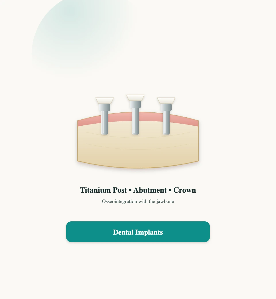 Dental Implants at PlanDental, Mahim, Mumbai