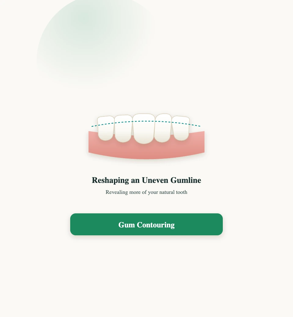 Gum Contouring at PlanDental, Mahim, Mumbai
